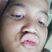 Thần Apollo Trỗ